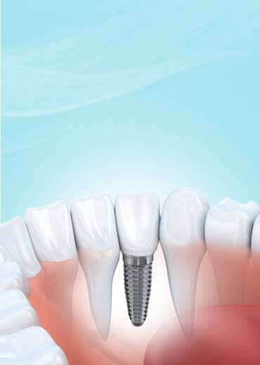 Lost Tooth Lost Tooth