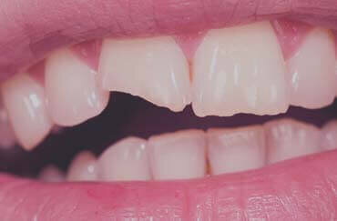 Broken Tooth Broken Tooth